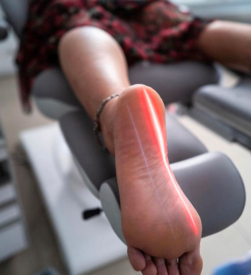 single-image-500-lllt-foot-treatment